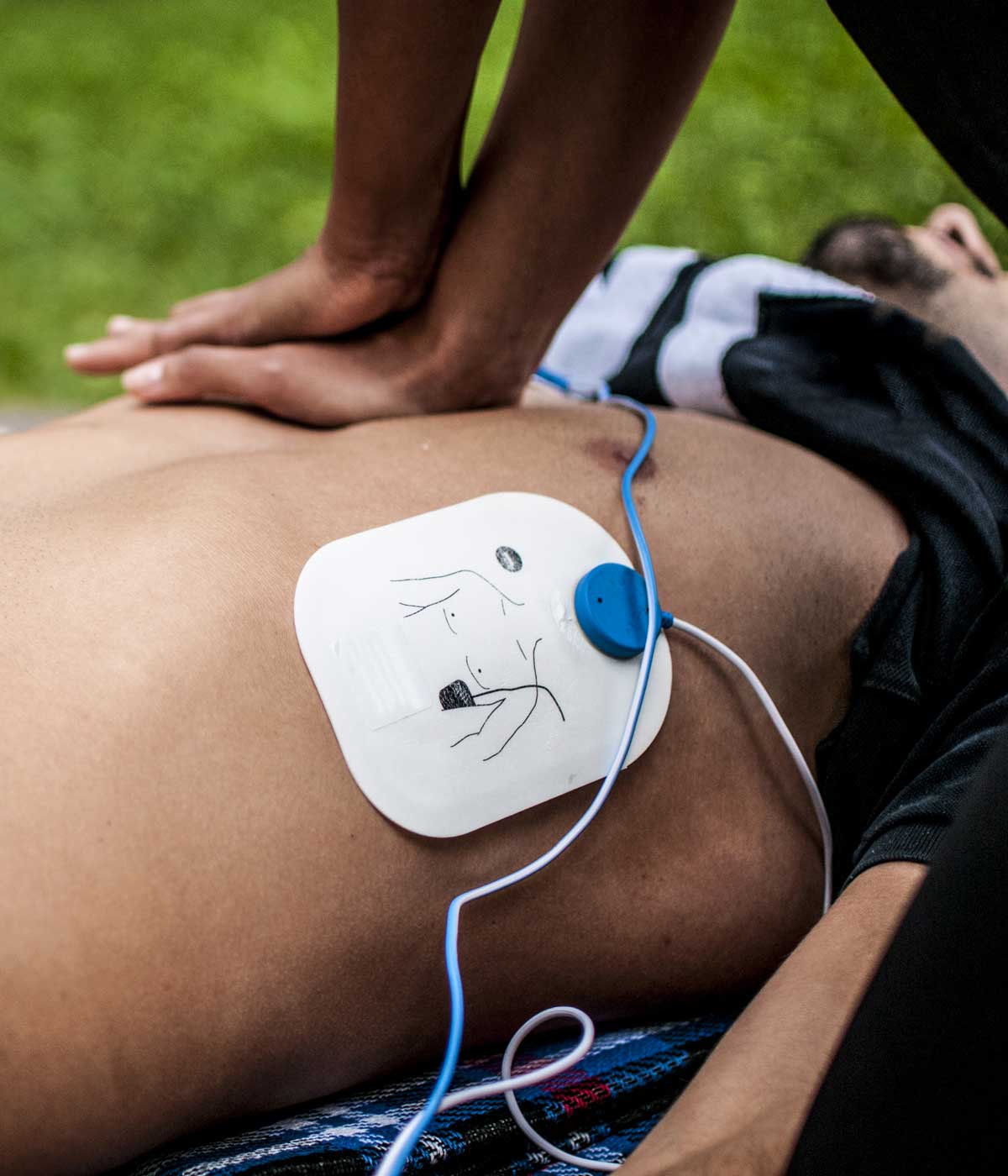 CPR with AED pad on man's chest outdoors